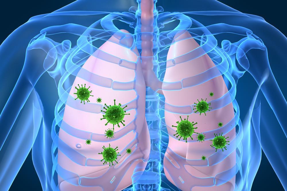 Болезни органов дыхания вызываемые вирусами