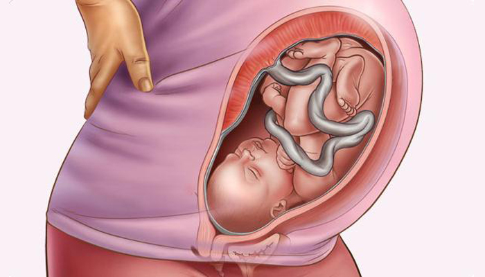 Ведение беременности при истмико-цервикальной недостаточности