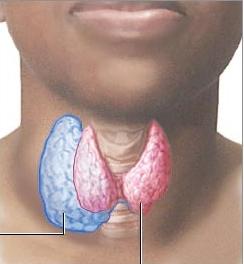 узловой зоб щитовидной железы 