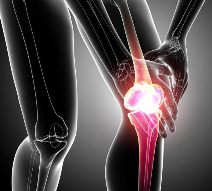  артрит артроз коленного сустава