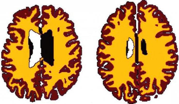 биоакустическая коррекция головного мозга в москве