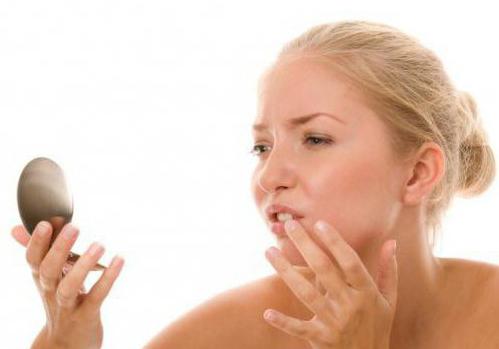 Раздражение и покраснение вокруг рта - возможные причины и особенности лечения