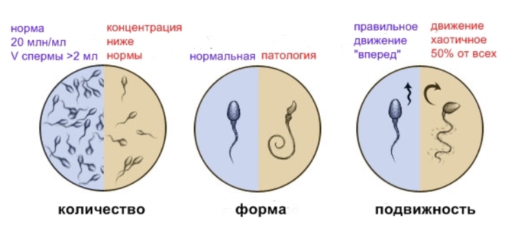 Анализ спермы