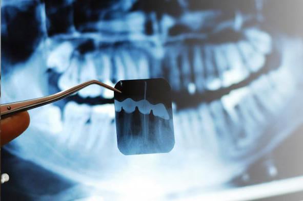 описание рентгеновских снимков зубов