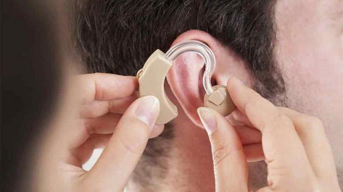 слуховые аппараты фирмы сименс