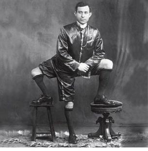 франческо лентини человек с тремя ногами 1889 г р сицилия 