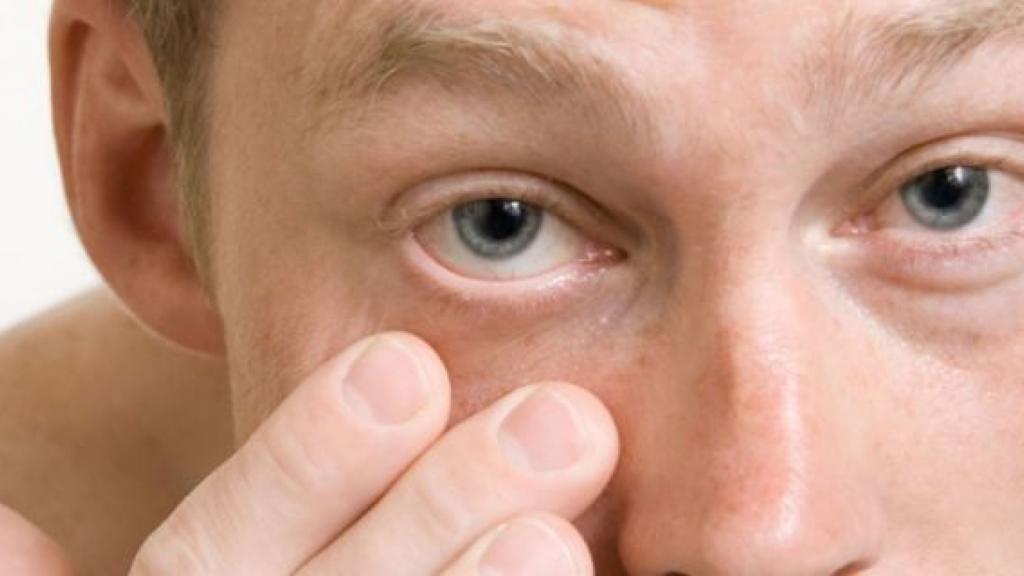 Воспалительные заболевания глаз: список, симптомы и лечение