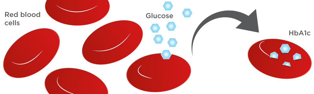 Гликированный гемоглобин при диабете
