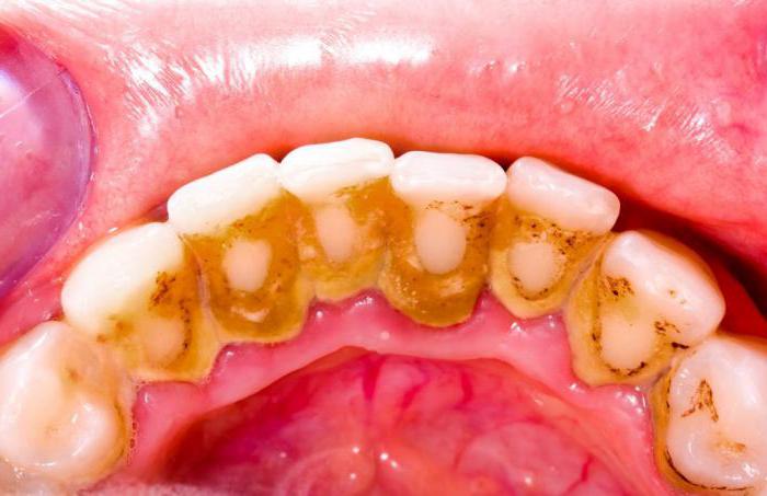 проблемы с зубами у детей