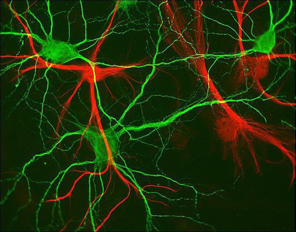 какие нейроны