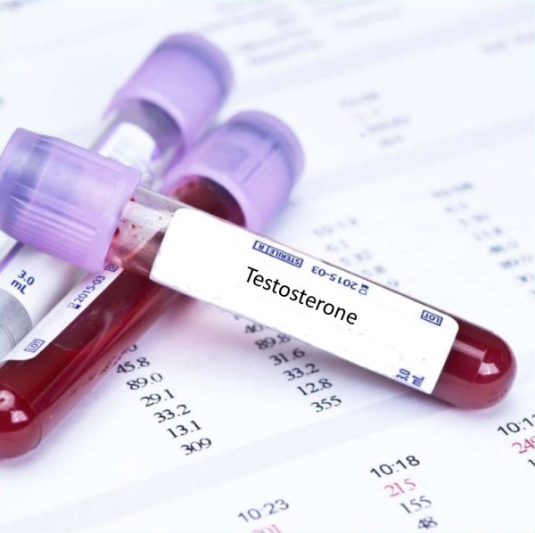 Анализ крови на тестостерон