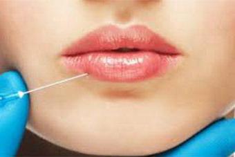 удаление биополимера из губ