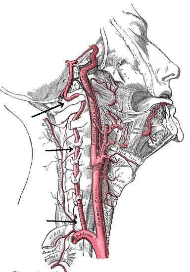 левая позвоночная артерия