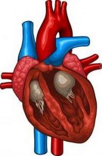 вторичная кардиопатия