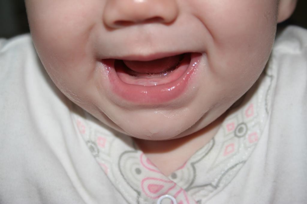 отсутствие зубов у ребенка в 9 месяцев