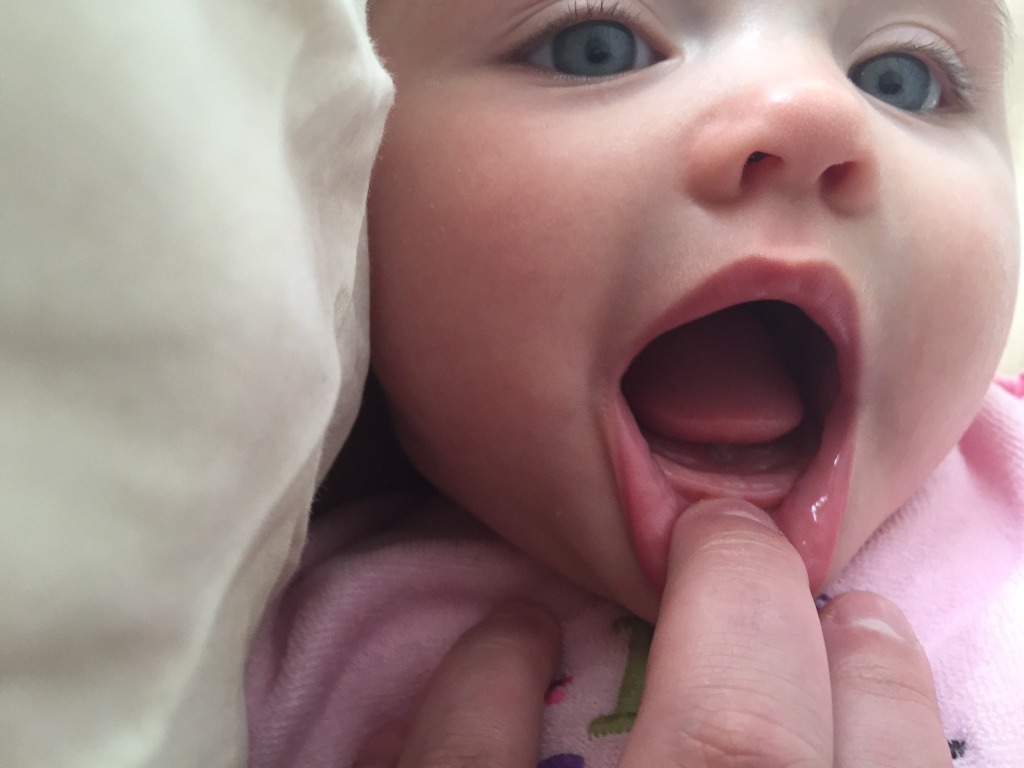 ребенку 9 месяцев нет зубов причина