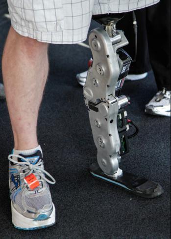 как работают бионические протезы