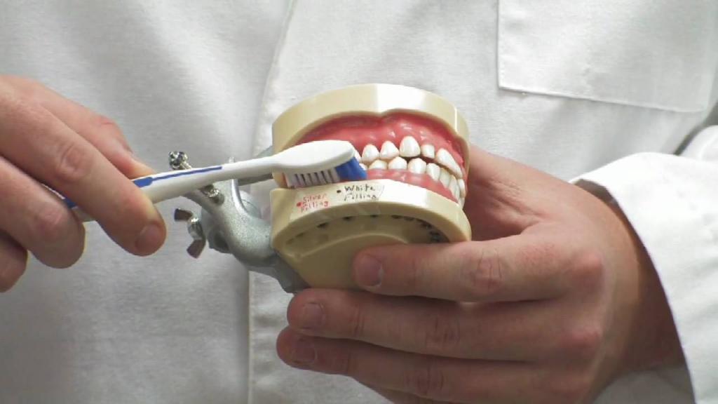 уход за съемными зубными протезами