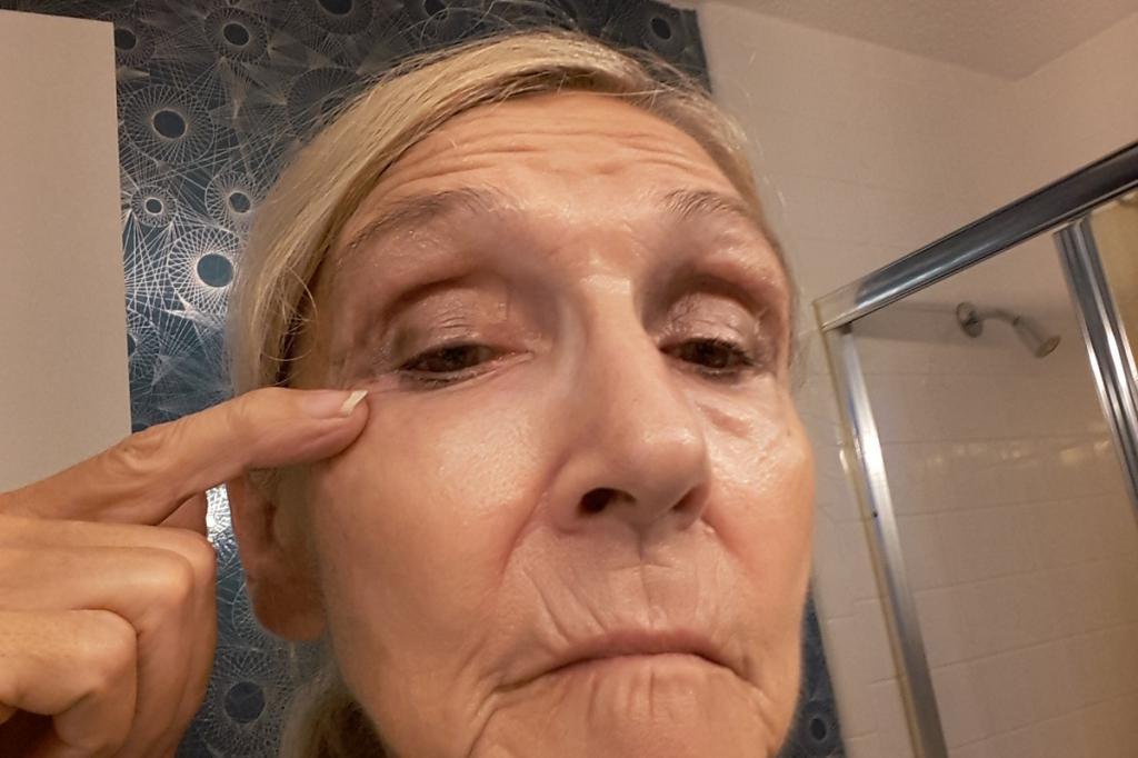 "Блефарогель" от морщин для лица и вокруг глаз: инструкция и отзывы косметологов