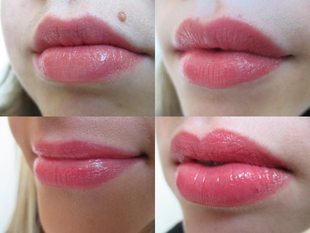 Филлер для губ "Ювидерм": какой выбрать, фото до и после, сколько держится результат
