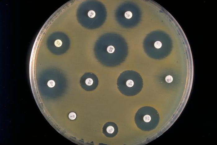 бактериологический метод исследования в микробиологии