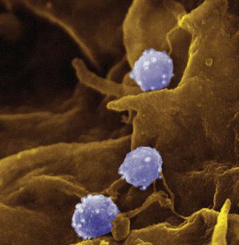 антитела к chlamydia trachomatis