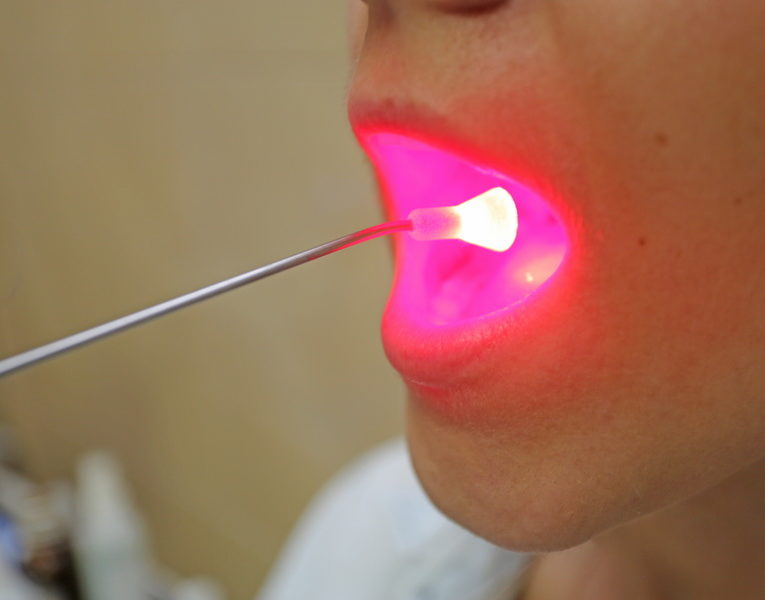 плоская лейкоплакия полости рта