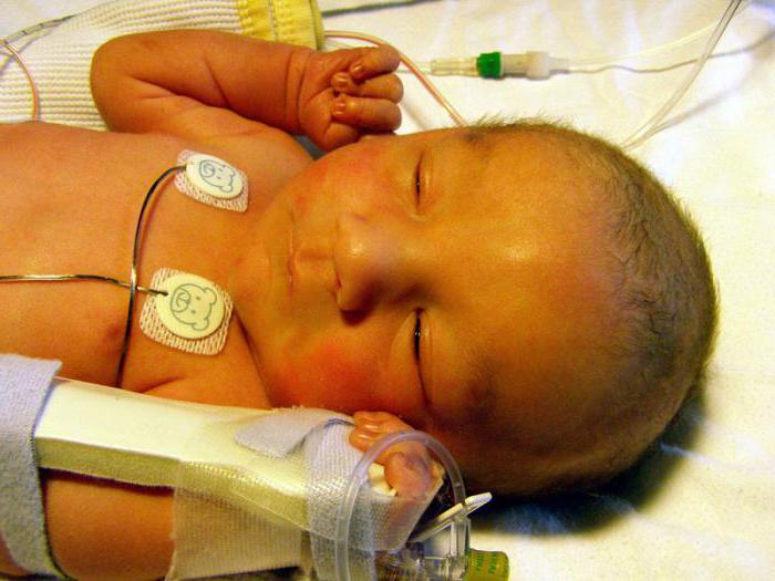 Какой должен быть билирубин у новорожденного