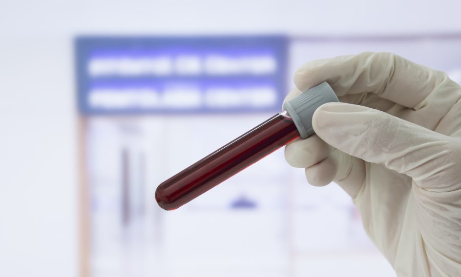 биохимический анализ крови базовый что входит