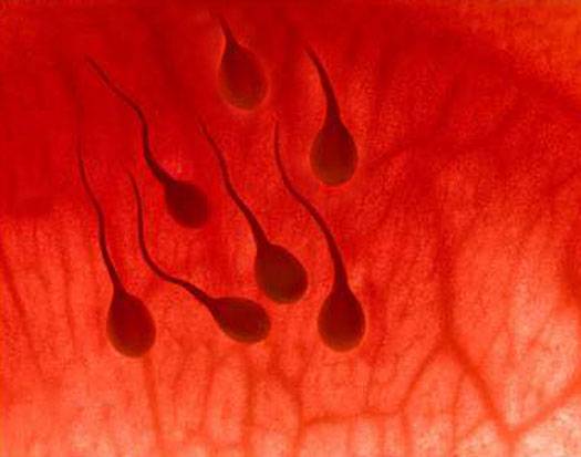 Почему сперма выходит с кровью