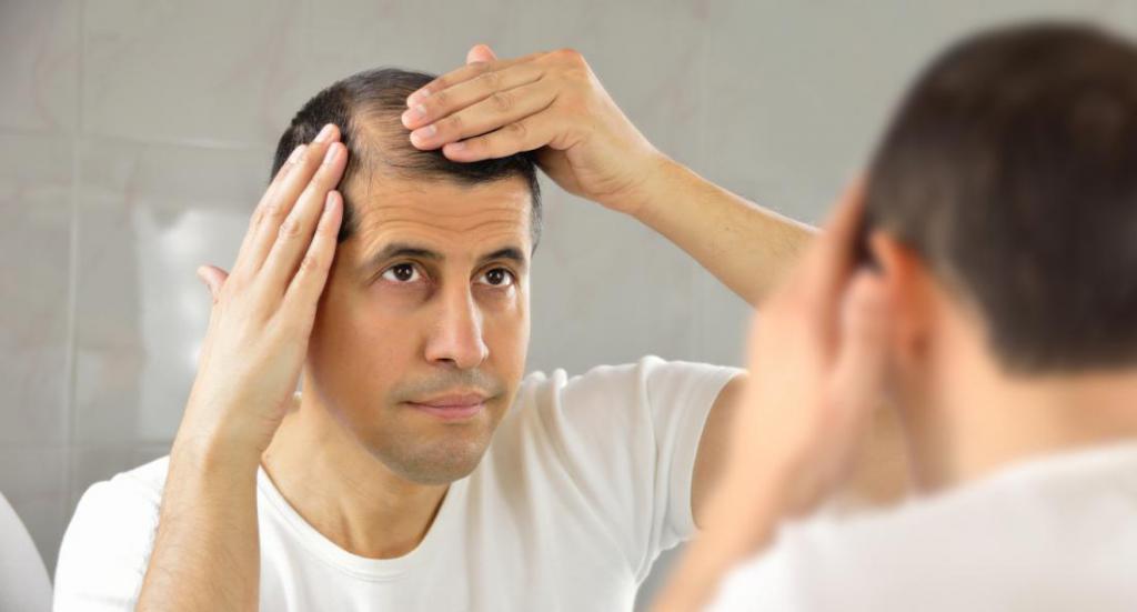 методы против выпадения волос
