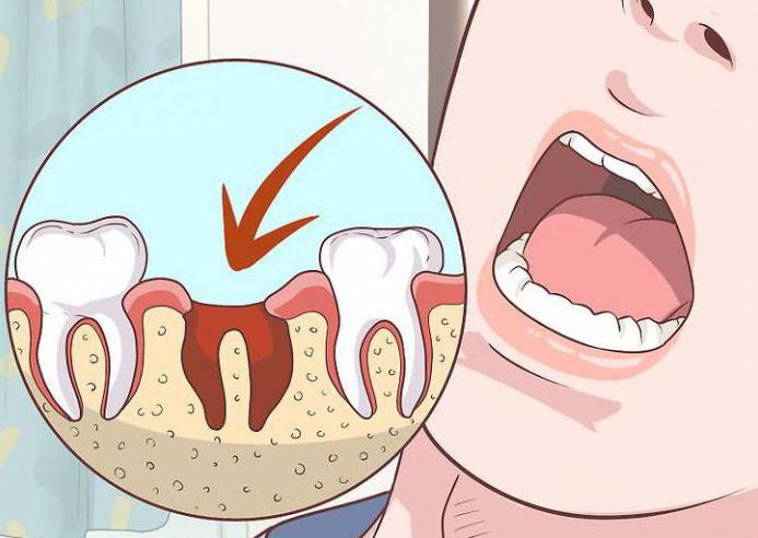 сколько заживает зуб после удаления