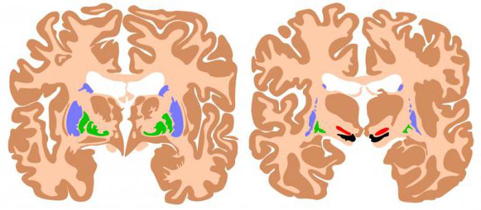 базальные ганглии головного мозга