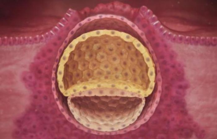 Имплантация оплодотворенной яйцеклетки