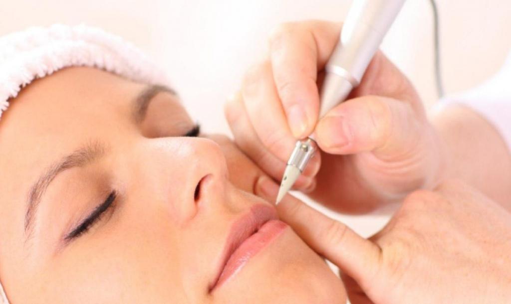 Удаление волос лазером на лице: отзывы, рекомендации, особенности проведения процедуры и противопоказания
