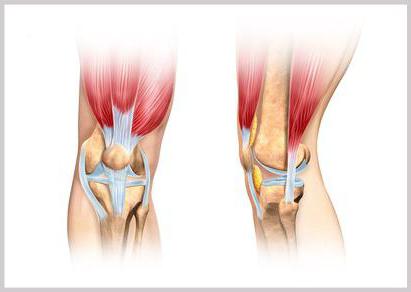 мрт анатомия коленного сустава