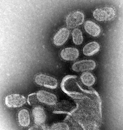 Вирус гриппа h1n1