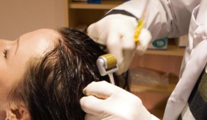 техника мезотерапии волосистой части головы
