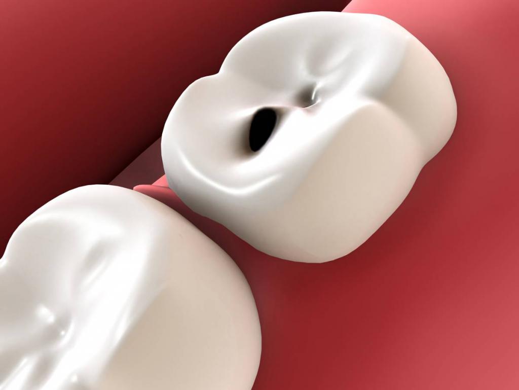 болят ли молочные зубы у детей при кариесе 3 года