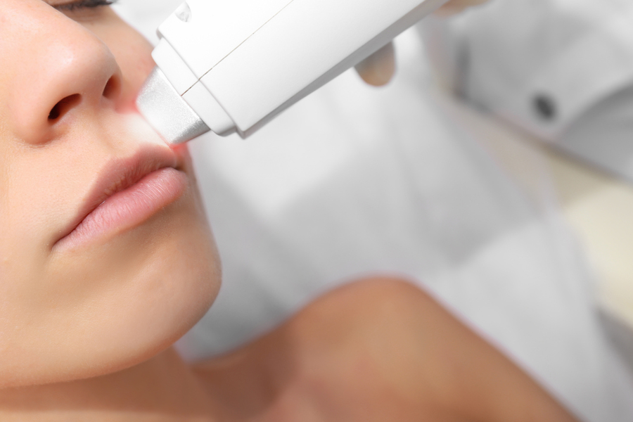 Лазерная эпиляция над губой: техника проведения процедуры, показания, противопоказания и результат
