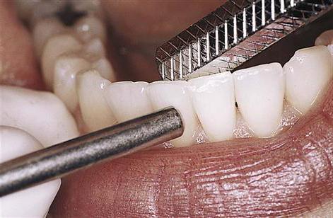степени подвижности зубов