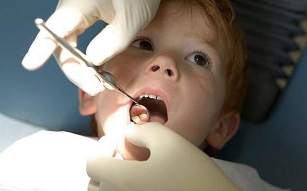 Как отличить молочный зуб от коренного в домашних условиях?
