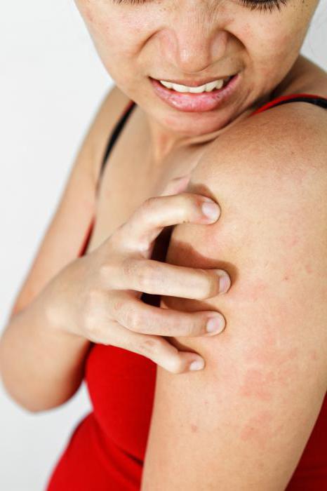 аллергия кожи на лейкопластырь