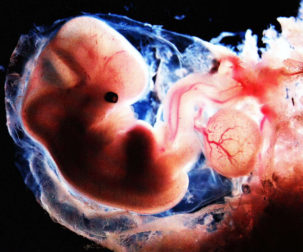 эмбрион на узи