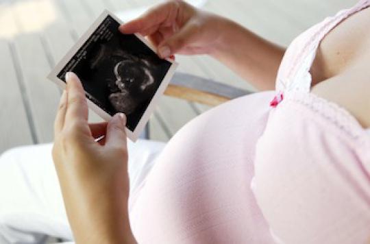 Беременная женщина смотрит снимок