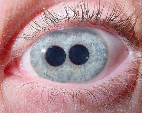 Зрачок глаза