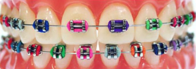 ортодонтические услуги стоматологии