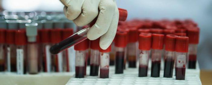 как проходит подготовка к биохимии сдача крови 