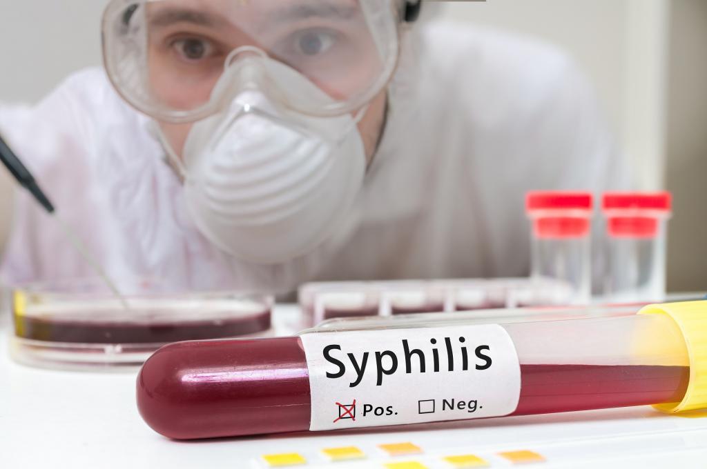 врожденный сифилис