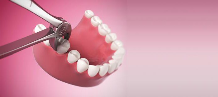 показания к удалению зуба стандарт